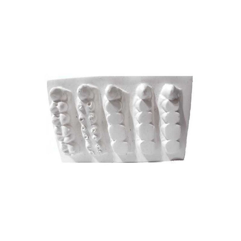 Tablilla de yeso para modelar | Laboratorio | Clinident Chilpancingo